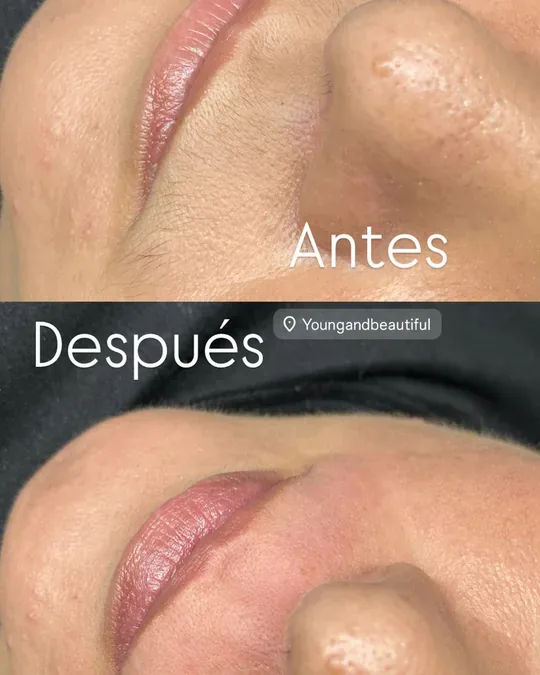 Young and Beautiful Spa Belleza · foto 1
