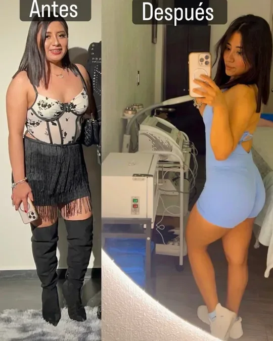 Cabina cosmetologica Galix Faciales ,Reductivos ,Depilacion Láser en Tuxtla Gutiérrez · foto 4