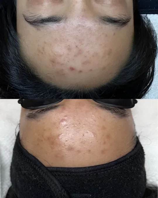 Ananda Spa · foto 1