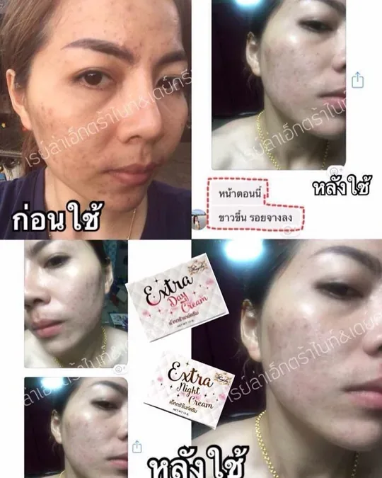 ADARA SKIN · foto 1