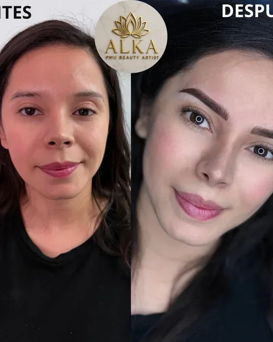 Alka Spa · foto 2