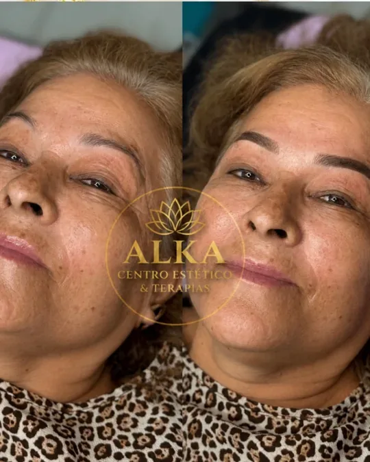 Alka Spa · foto 4