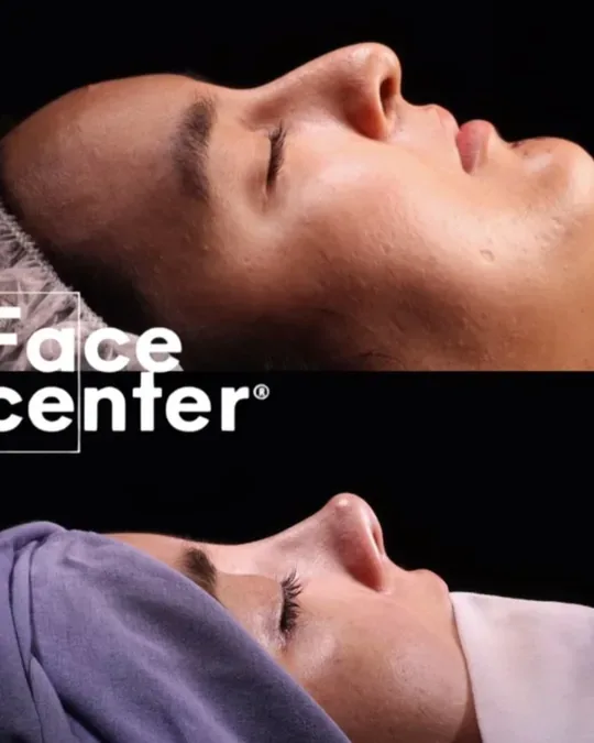 Face Center · foto 4