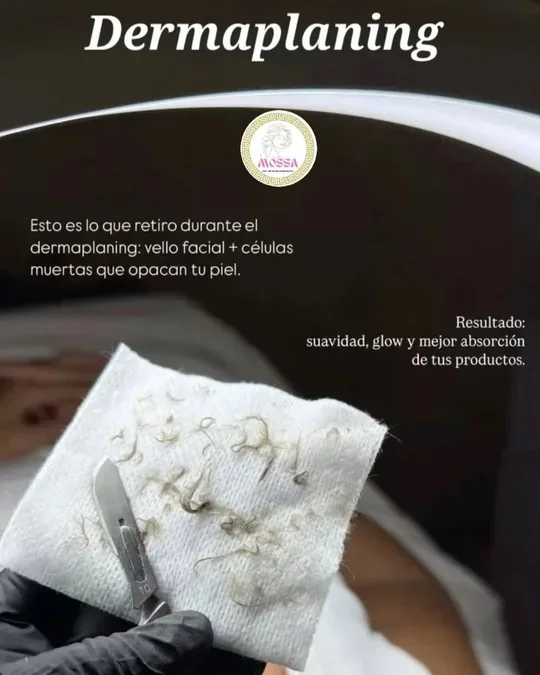 MOSSA Spa · foto 2