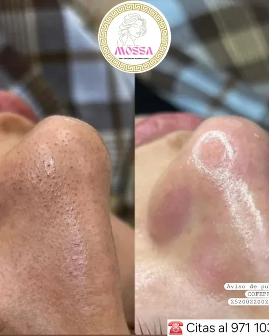 MOSSA Spa · foto 3