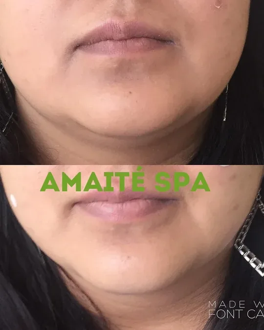 Amaité Spa · foto 3