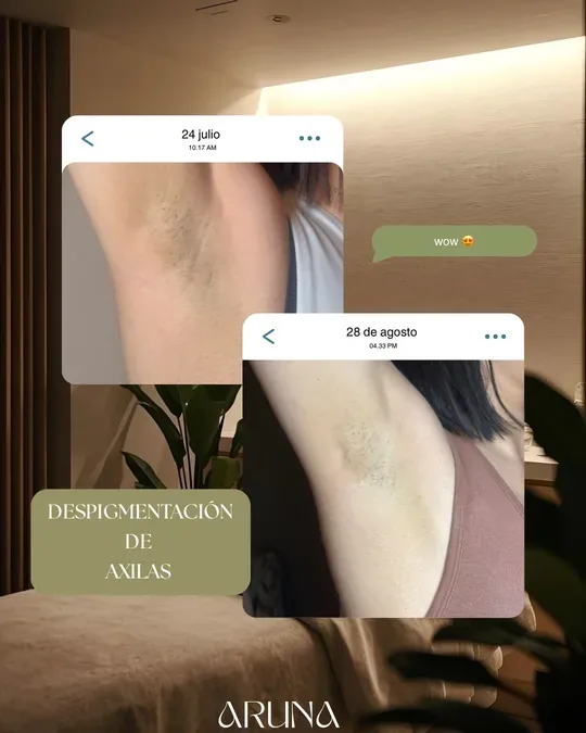 Aruna spa · foto 1