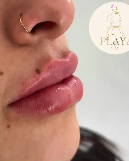 PLAYA spa · foto 1