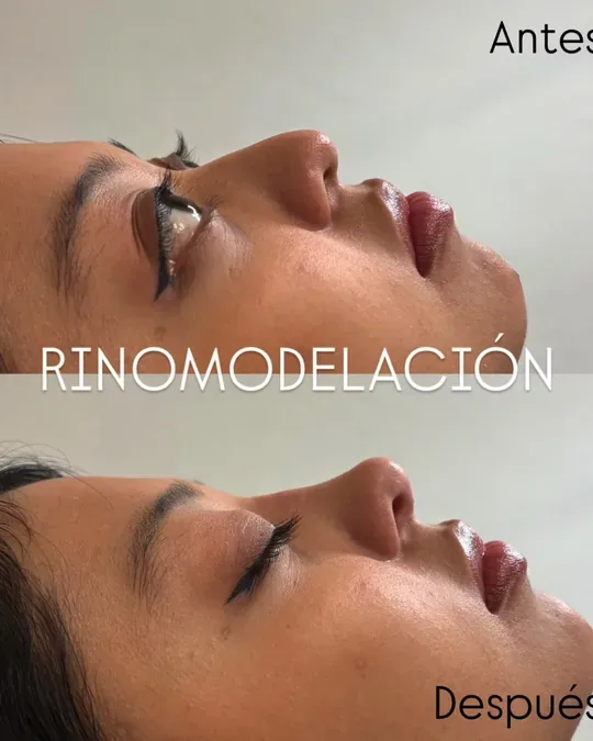 PLAYA spa · foto 2