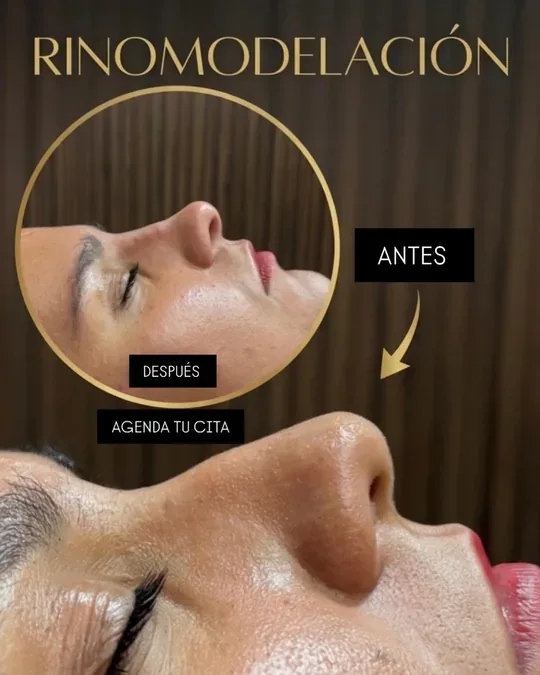 PLAYA spa · foto 3