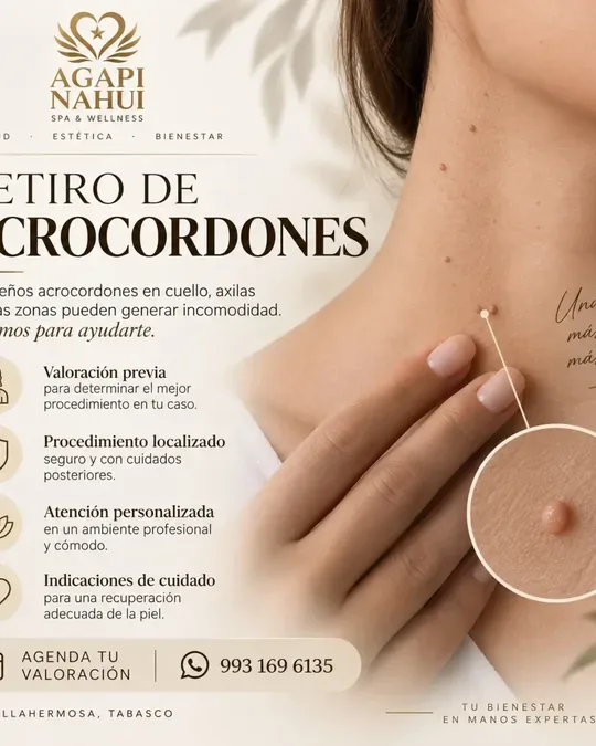 Agapi Nahui Spa & Wellness · foto 2
