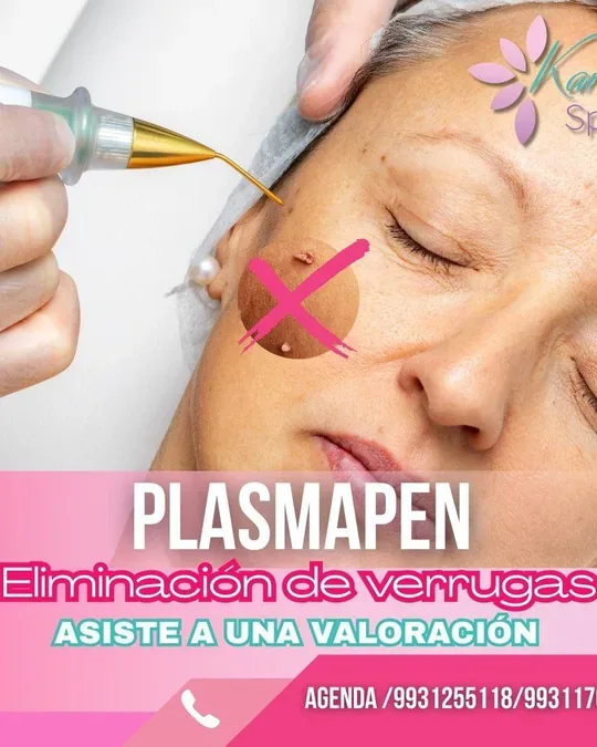 KARINA SPA USUMA · foto 2