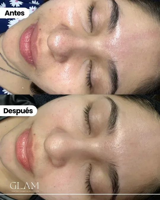 Glam centro cosmetologico spa · foto 3