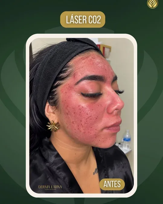Derma Latina · foto 2