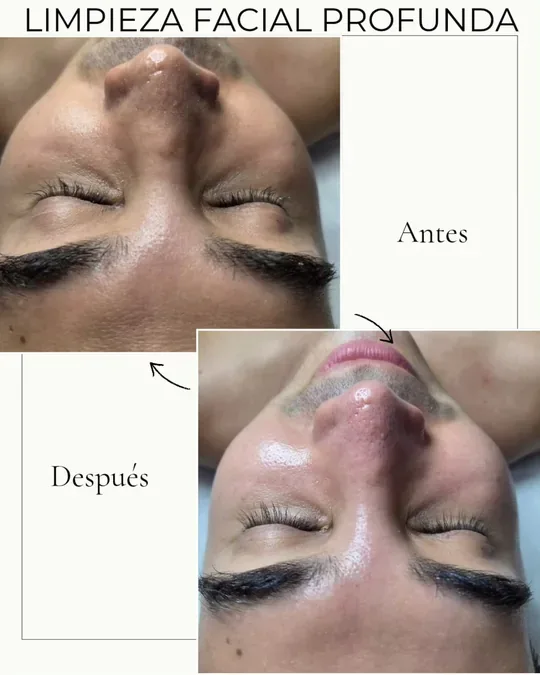 Verabella Spa · foto 4
