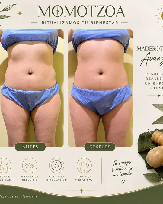 Momotzoa spa · foto 1