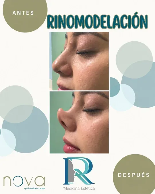NOVA Spa & wellness center · foto 2