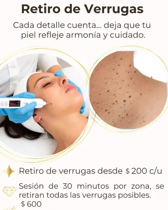 Lakshmi Spa · foto 2