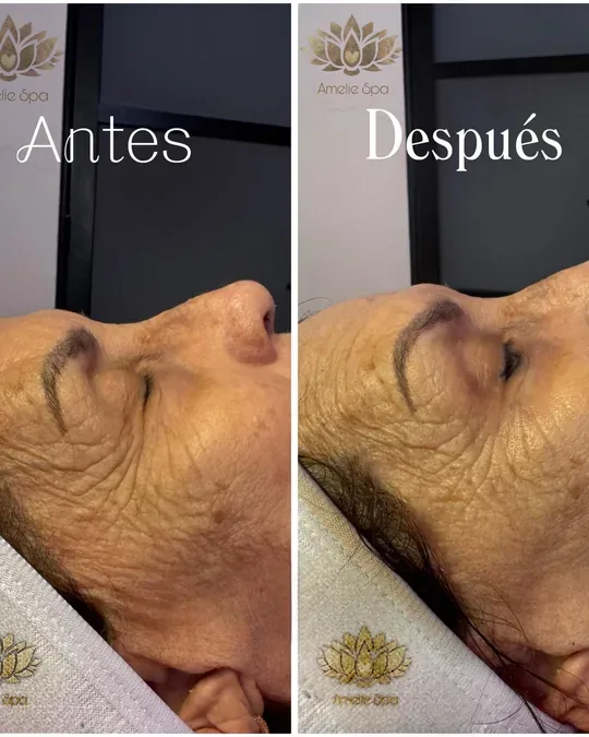 Amelie spa · foto 4