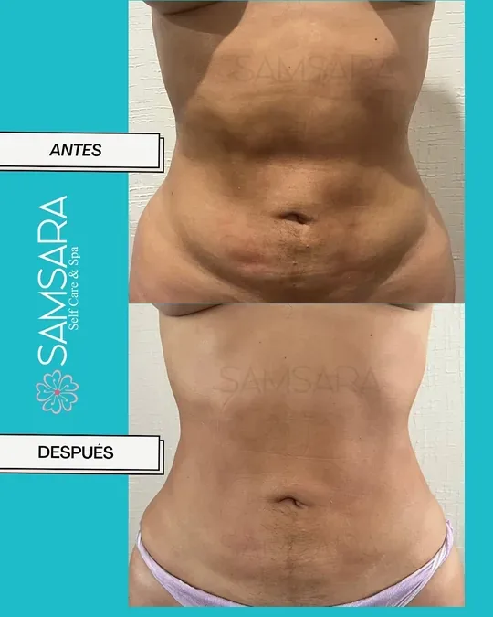 Samsara Postoperatorios xalapa · foto 4