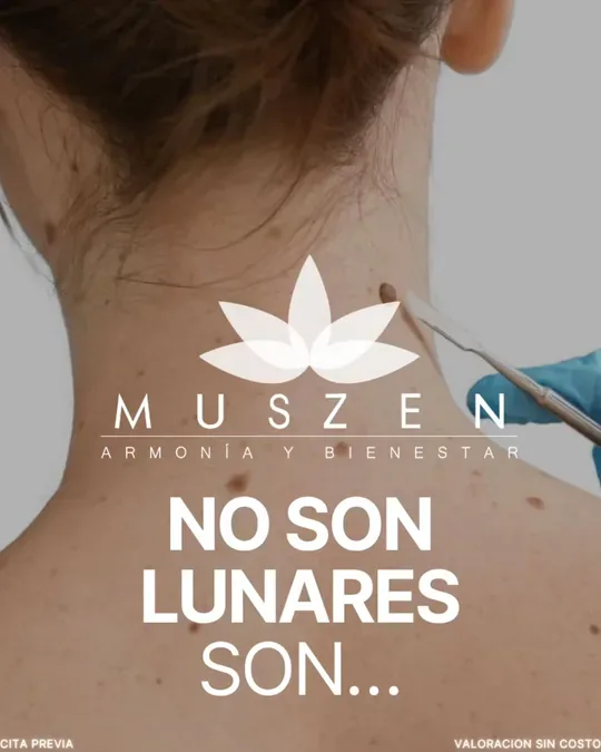 Muszen Spa · foto 3