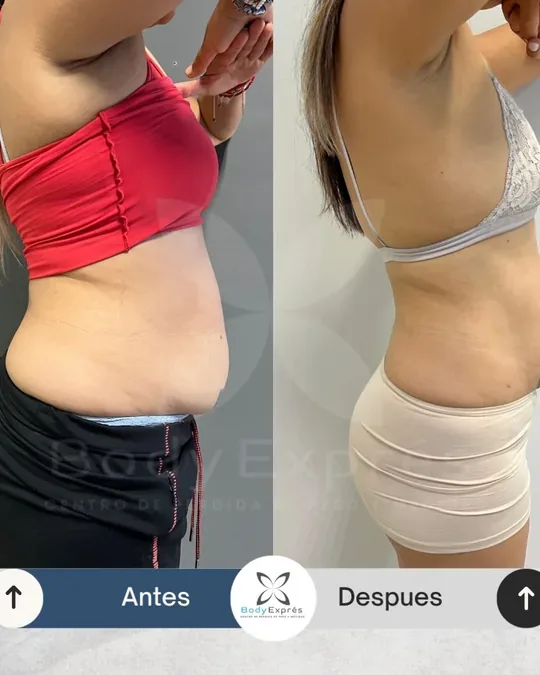 Body Exprés · foto 1