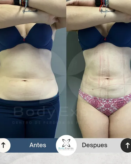 Body Exprés · foto 2