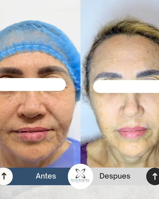 Body Exprés · foto 3