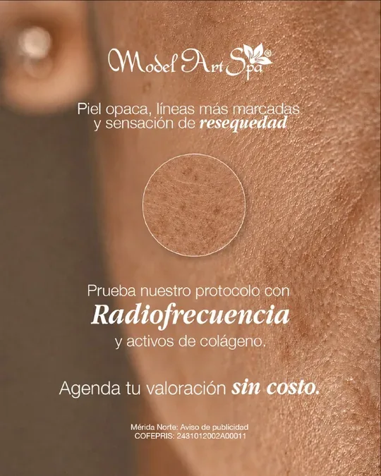 Model Art Spa Mérida Norte · foto 3