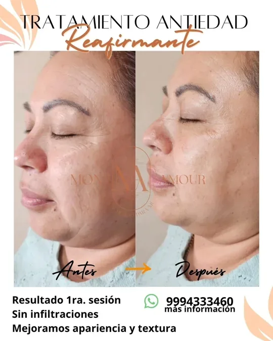 Spa en Mérida · foto 1